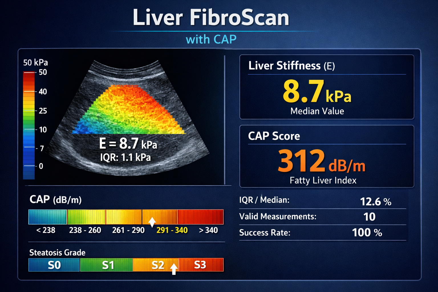 Liver FibroScan with CAP